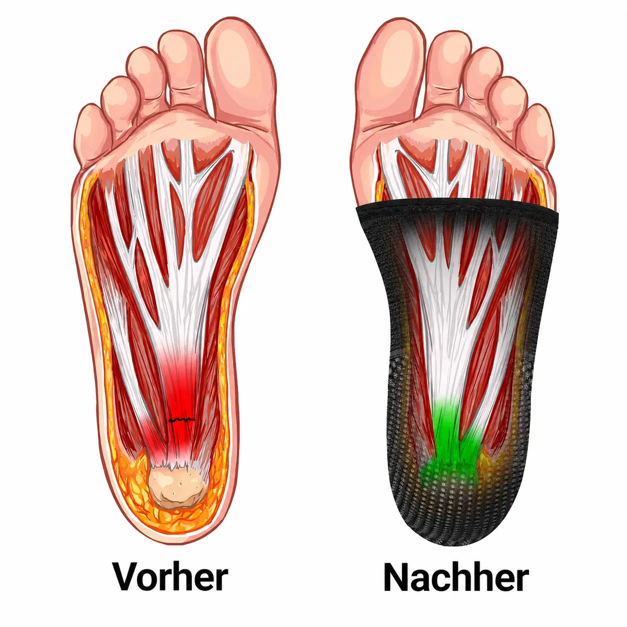 Durchblutung Vorher Nachher